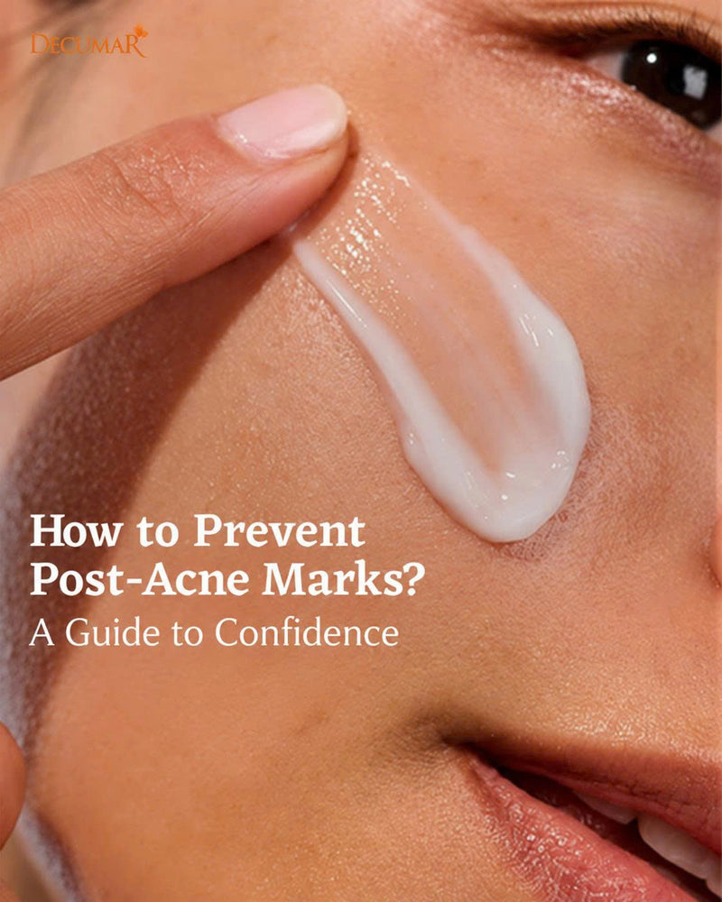 How to Prevent Post-Acne Marks? A Guide to Confidence