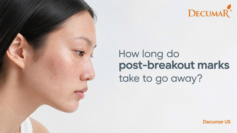 How long do post-breakout marks take to go away?