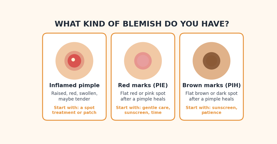 Know your blemish type first